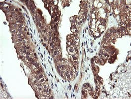 MAP2K1 / MKK1 / MEK1 Antibody (clone OTI1A10)