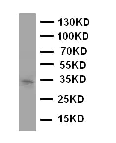 Polyclonal Rabbit anti-Human AQP10 / Aquaporin 10 Antibody (aa286-301, WB)