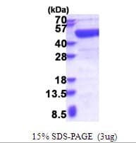 Human PAICS / ADE2 Protein (Recombinant His)