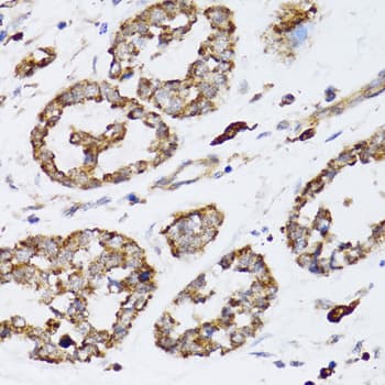 Polyclonal Rabbit anti-Human CCN5 Antibody (IHC, WB)