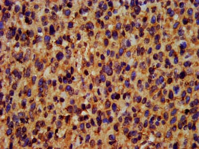 TRIM35 Antibody