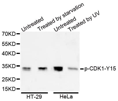 CDK1 / CDC2 Antibody (phospho-Tyr15)