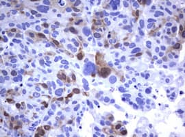 TS / Thymidylate Synthase Antibody (clone OTI1A3)