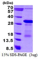 Human DBNDD1 Protein (Recombinant His)