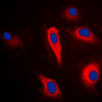 PLA2G4A Antibody (Internal)