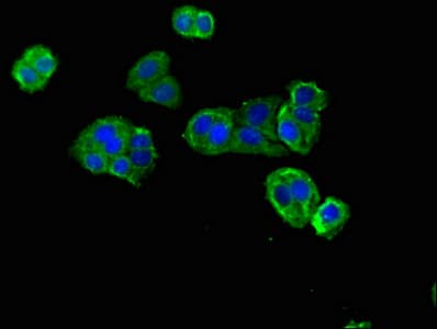 DNAH12 Antibody