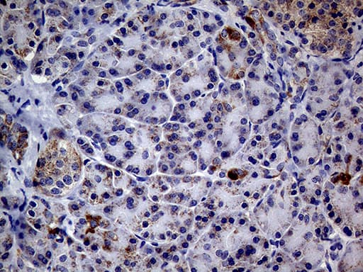 Monoclonal Mouse anti-Human MRPL15 Antibody (clone OTI10B10, aa28-296, IHC, WB)