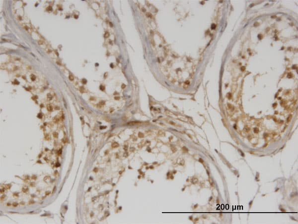 DMAP1 Antibody (clone 2G12)