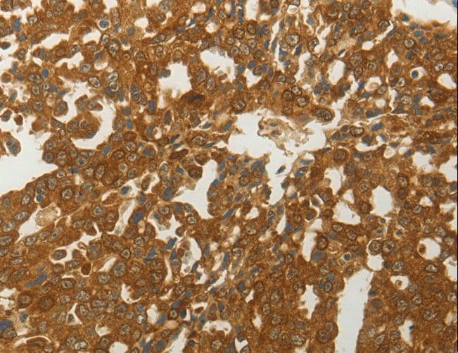 MC4R / Melanocortin 4 Receptor Antibody