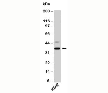 NIFK / MKI67IP Antibody (clone NFK8436)