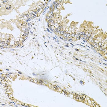 Polyclonal Rabbit anti-Human CML / BCR Antibody (IHC, WB)