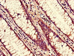 NUP85 / Pericentrin 1 Antibody