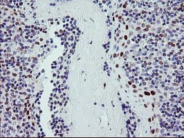 BACH1 Antibody (clone OTI4E11)