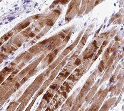 C2orf40 / ECRG4 Antibody
