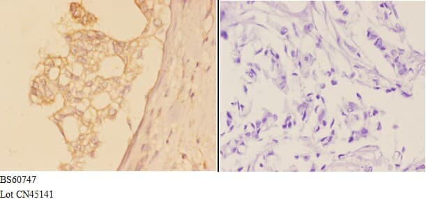 ADAM19 Antibody
