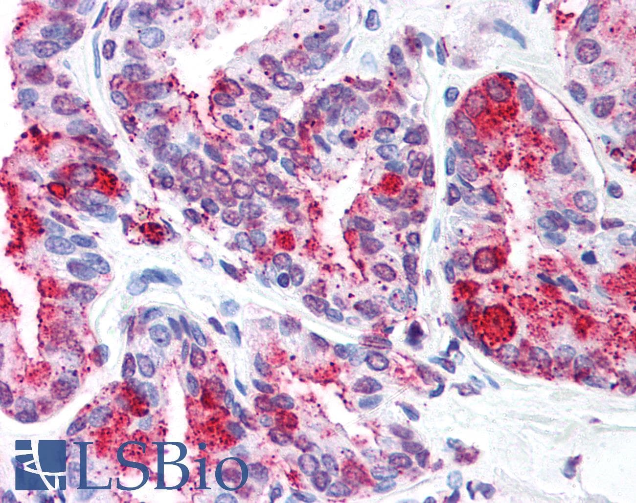 IHC-plus™ WNT5B Antibody (Internal)