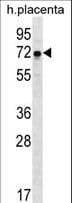 GLCNE / GNE Antibody (aa169-197)