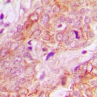 UBE3B Antibody (Internal)