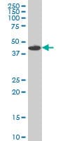 IHC-plus™ MKNK1 / MNK1 Antibody (clone 2F12)