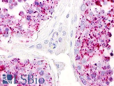 PathPlus™ LPAR5 / GPR92 Antibody (Cytoplasmic Domain)