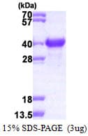 Human NACA Protein (Recombinant His)