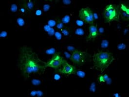 SPRING / TRIM9 Antibody (clone OTI1G10)