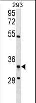 RPF2 / BXDC1 Antibody (aa272-299)