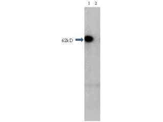HDAC1 Antibody (Internal)