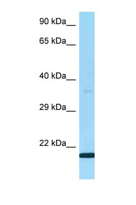 G5B / LY6G5B Antibody (aa60-109)