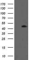 MAP2K1 / MKK1 / MEK1 Antibody (clone OTI2A9)