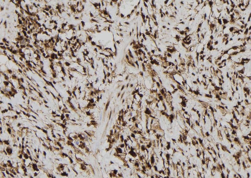 MAGEB10 Antibody
