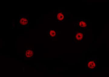 IKZF4 / EOS Antibody