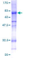 Human COL6A2 / Collagen VI Alpha 2 Protein (Recombinant GST)