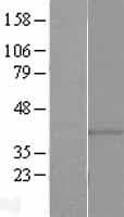 GPR146 Protein (Over-Expression Lysate Myc-DDK (Flag))