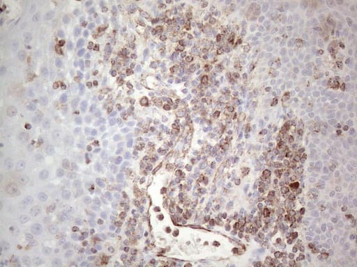 Peripherin Antibody (clone UMAB202, Carrier-free)