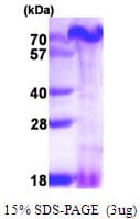Human PAGR1 / C16orf53 Protein (Recombinant His)