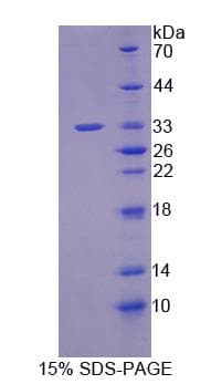 Mouse JPH3 Protein (Recombinant His, N-Terminal)