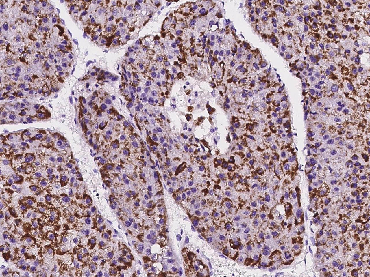 Polyclonal Rabbit anti-Human IFT20 Antibody (IHC)