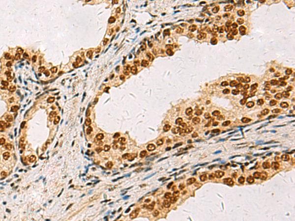 Polyclonal Rabbit anti-Human ELF5 Antibody (IHC)