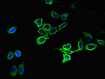Polyclonal Rabbit anti-Human ATP1A1 Antibody (IHC, IF)