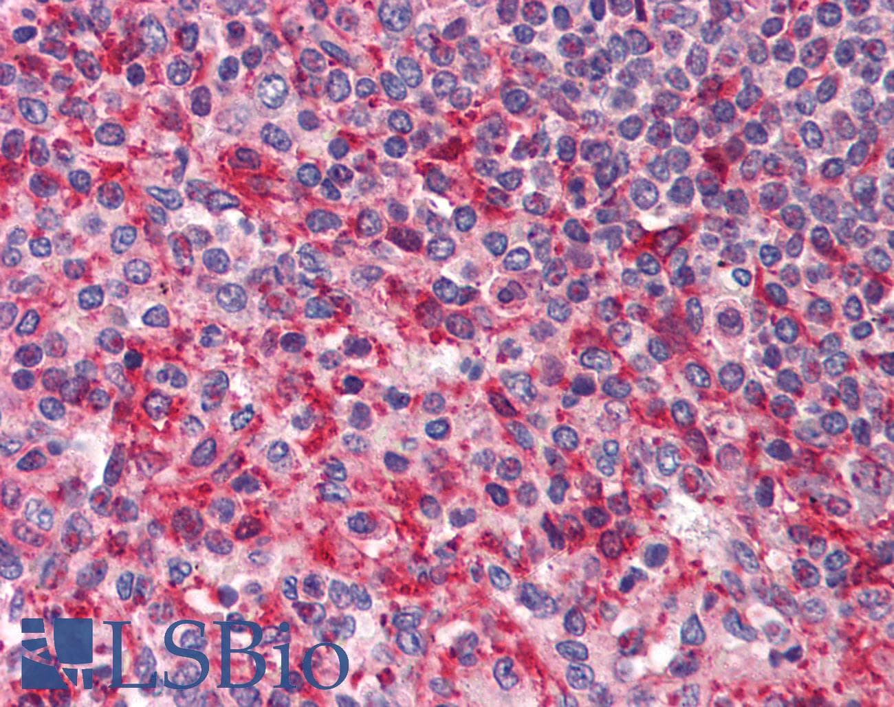 IHC-plus™ Polyclonal Rabbit anti-Human PAK4 Antibody (IHC, IF, WB)