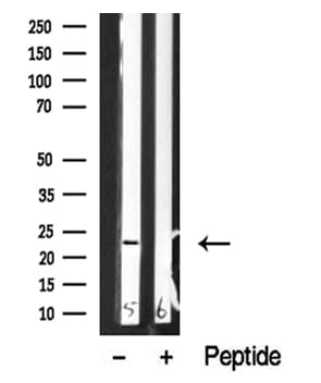 Polyclonal Rabbit anti-Human NACA Antibody (WB)