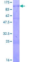 Human DDX3 / DDX3X Protein (Recombinant GST)