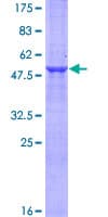 Human RSG1 Protein (Recombinant GST)