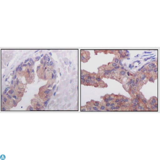 AMACR / P504S Antibody