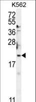 Polyclonal Rabbit anti-Human BTG2 Antibody (aa33-61, IHC, WB)