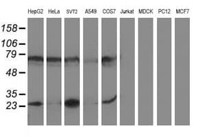IHC-plus™ PGAM2 Antibody (clone 4E9)