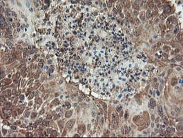 GCP60 / ACBD3 Antibody (clone OTI5F9)