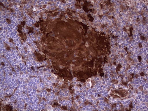 LGALS3 / Galectin 3 Antibody (clone OTI7G9)