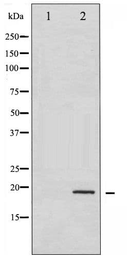 Polyclonal Rabbit anti-Human CFL1 / Cofilin Antibody (phospho-Ser3, WB)